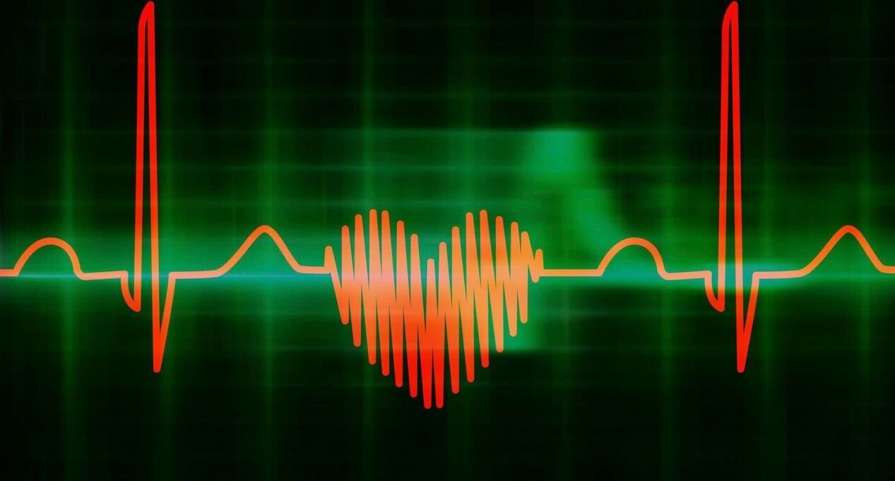 TachyCardia